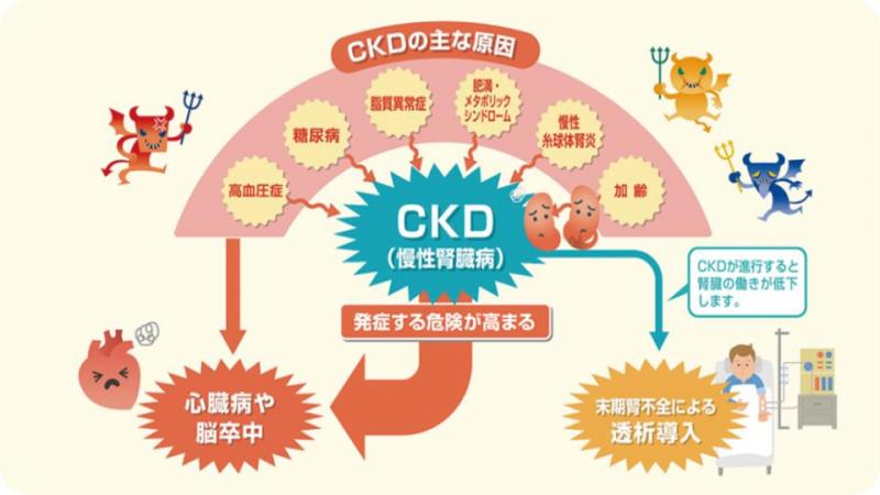 ckd ckd